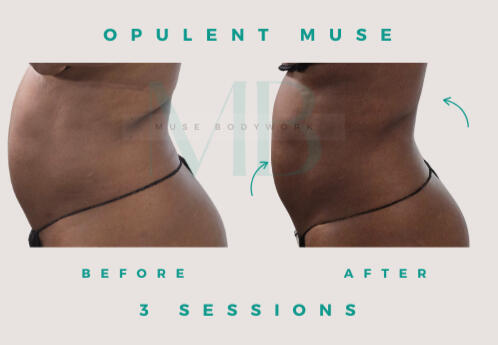 Body Sculpting Body Sculpting